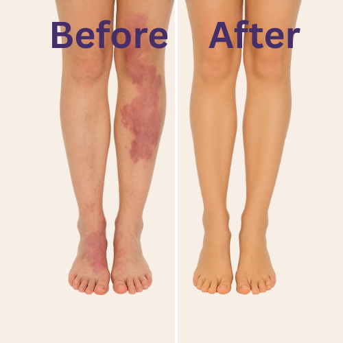 Pink Press™ Body Coverage Perfector